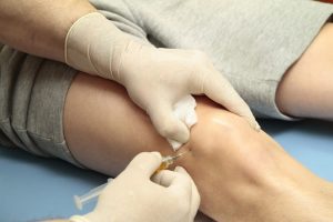 Diz Eklemlerine Kök Hücre Tedavisi